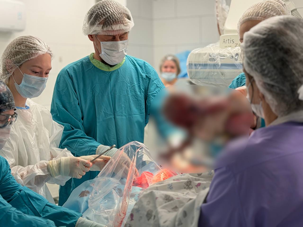 Врачи 1-й РКБ Удмуртии успешно провели сложную гибридную операцию и спасли жизнь матери и ее новорожденного ребенка Врачи 1-й РКБ Удмуртии успешно провели сложную гибридную операцию и спасли жизнь матери и ее новорожденного ребенка