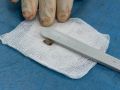 Ижевские врачи спасли мужчину с минно-взрывным ранением